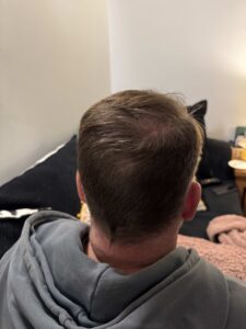 12 month back of head