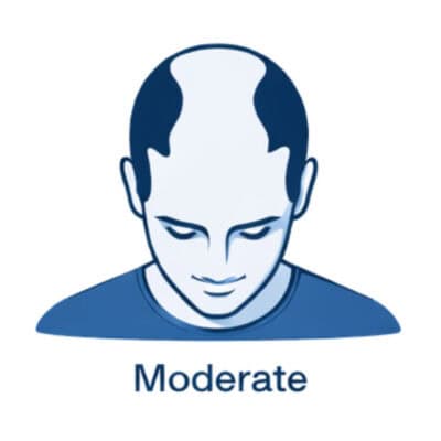 Image for choice number 3