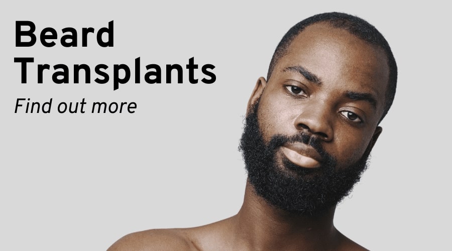 Hair Transplant Bristol Beard Transplantation image