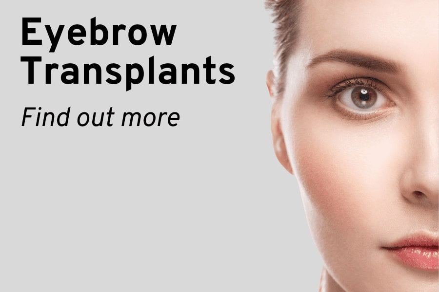 Hair Transplant Bristol Eyebrow transplantation image