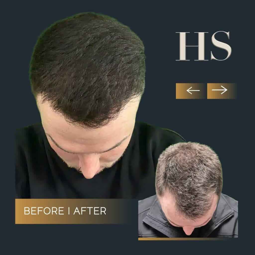 Harley Street HT Pt before and after 1