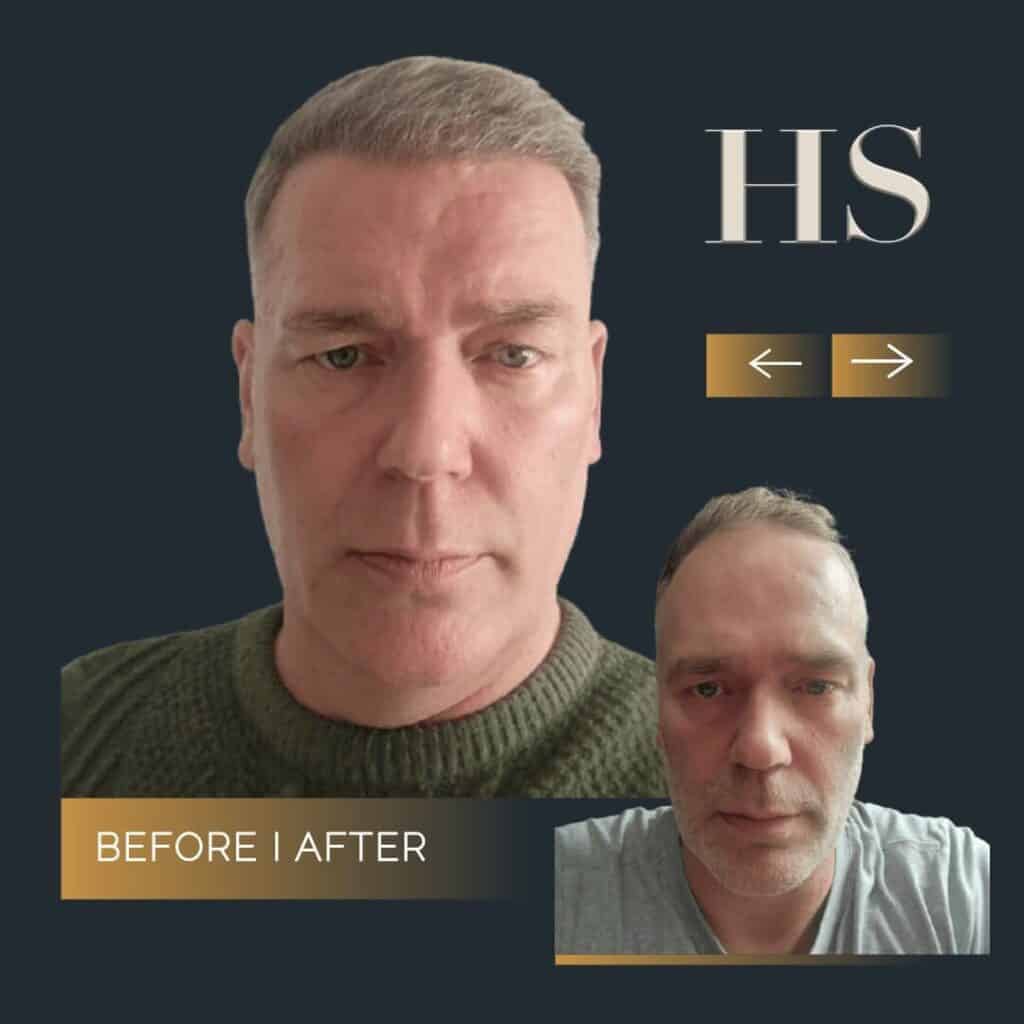 Harley Street HT pt Ed