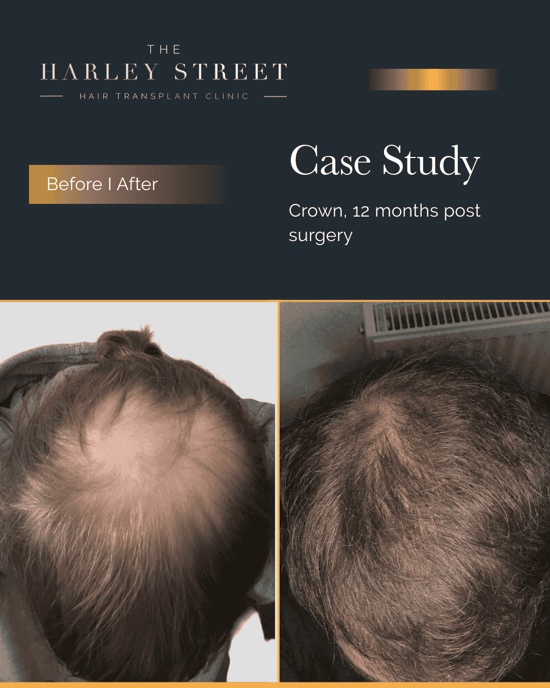 Harley Street HT pt, Wagstaff, crown