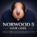 Norwood 5 Norwood 5 on the hair loss scale