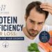 Protein Deficiency Hair Loss: Protein for Hair Growth Protein Deficiency Hair Loss