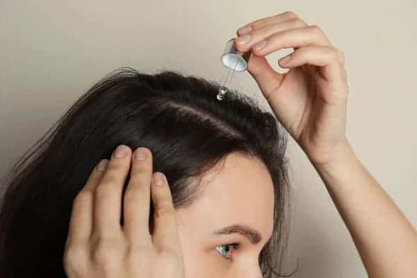 Azelaic Acid for Hair Loss 1 azelaic acid for hair loss and growth