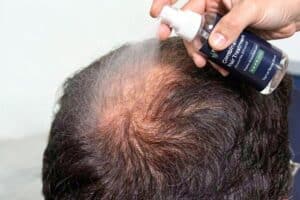 combination spray being sprayed on thinning crown