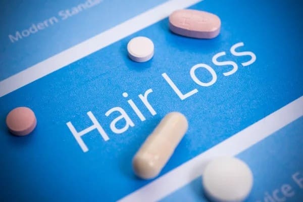 hair loss medication