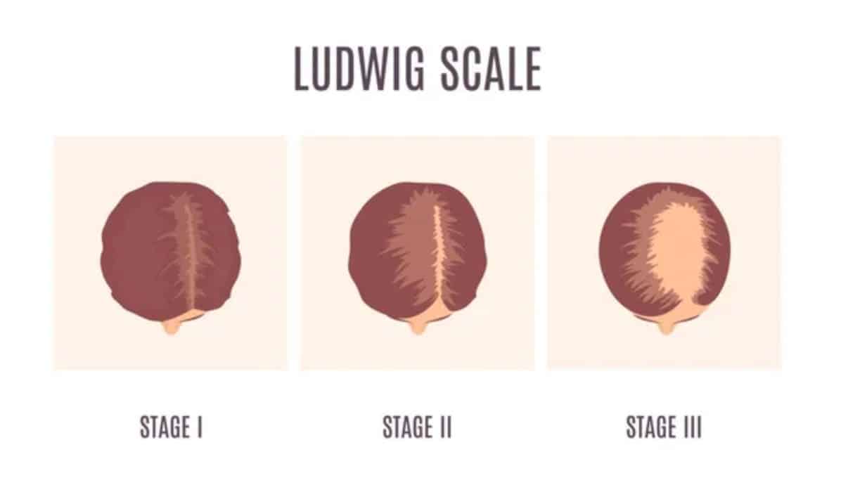 The Ludwig Scale ludwig scale 1 2 3