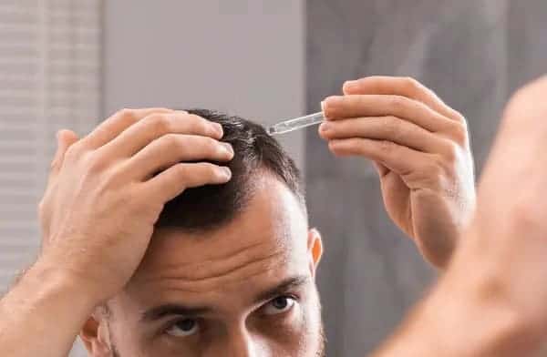 Topical Finasteride for Hair Loss man applying topical finasteride to scalp