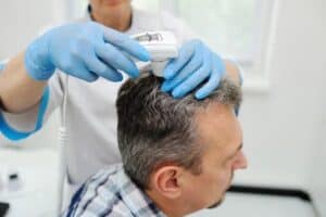 man with hair loss under trichoscope exame