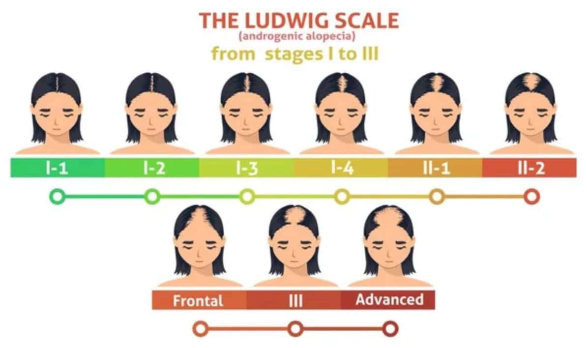 The Ludwig Scale the ludwig scale stages